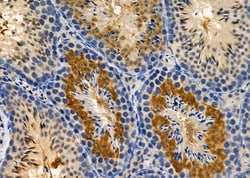 Invitrogen CLASRP Polyclonal Antibody 100 &mu;L; Unconjugated:Antibodies,