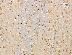 Invitrogen UBE2A/UBE2B Polyclonal Antibody 100 &mu;L; Unconjugated:Antibodies,