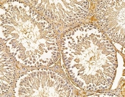 Invitrogen UBE2A/UBE2B Polyclonal Antibody 100 &mu;L; Unconjugated:Antibodies,