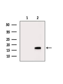 Invitrogen UBE2A/UBE2B Polyclonal Antibody 100 &mu;L; Unconjugated:Antibodies,