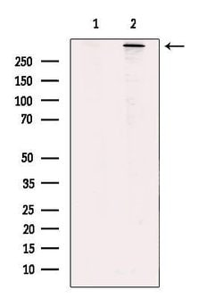 Invitrogen RyR2 Polyclonal Antibody 100 &mu;L; Unconjugated:Antibodies,