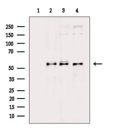 Invitrogen Phospho-AKT1/AKT2/AKT3 (Ser473) Polyclonal Antibody 100 &mu;L;