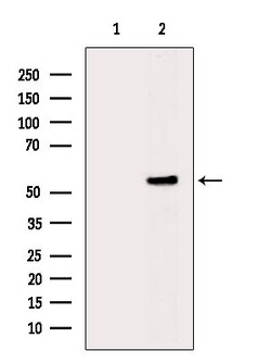 Invitrogen Phospho-AKT1/AKT2/AKT3 (Ser473) Polyclonal Antibody 100 &mu;L;