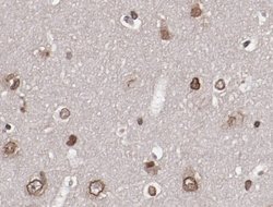 Invitrogen Phospho-AKT1/AKT2/AKT3 (Ser473) Polyclonal Antibody 100 &mu;L;
