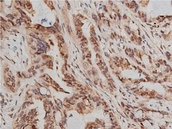 Invitrogen Phospho-AKT1/AKT2/AKT3 (Ser473) Polyclonal Antibody 100 &mu;L;