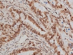 Invitrogen Phospho-AKT1/AKT2/AKT3 (Ser473) Polyclonal Antibody 100 &mu;L;