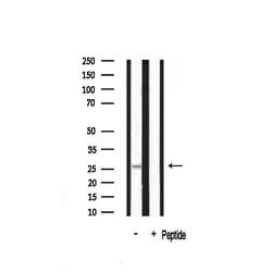 Invitrogen 14-3-3 beta/zeta Polyclonal Antibody 100 &mu;L; Unconjugated:Antibodies,