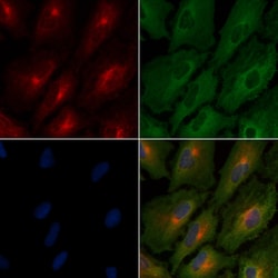 Invitrogen RON Polyclonal Antibody 100 &mu;L; Unconjugated:Antibodies,