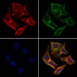 Invitrogen RON Polyclonal Antibody 100 &mu;L; Unconjugated:Antibodies,