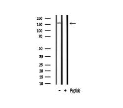 Invitrogen RON Polyclonal Antibody 100 &mu;L; Unconjugated:Antibodies,
