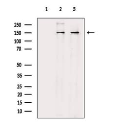 Invitrogen RON Polyclonal Antibody 100 &mu;L; Unconjugated:Antibodies,