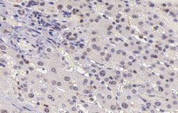 Invitrogen CARD6 Polyclonal Antibody 100 &mu;L; Unconjugated:Antibodies,