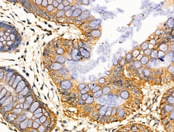 Invitrogen CARD6 Polyclonal Antibody 100 &mu;L; Unconjugated:Antibodies,