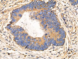 Invitrogen CARD6 Polyclonal Antibody 100 &mu;L; Unconjugated:Antibodies,