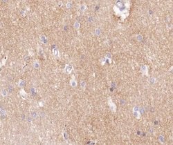 Invitrogen Factor VIII Polyclonal Antibody 100 &mu;L; Unconjugated:Antibodies,