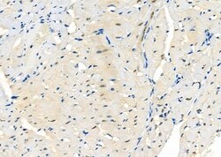 COPS3 Polyclonal Antibody:Antibodies, Polyclonal