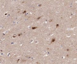 Invitrogen JM4 Polyclonal Antibody 100 &mu;L; Unconjugated:Antibodies,