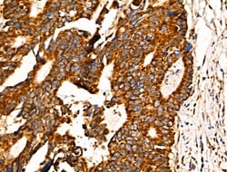 Invitrogen JM4 Polyclonal Antibody 100 &mu;L; Unconjugated:Antibodies,