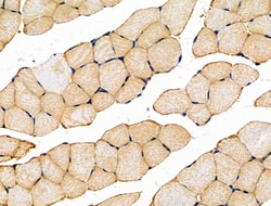 Invitrogen JM4 Polyclonal Antibody 100 &mu;L; Unconjugated:Antibodies,