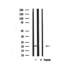 Invitrogen JM4 Polyclonal Antibody 100 &mu;L; Unconjugated:Antibodies,