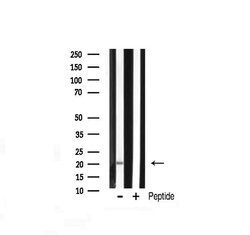 Invitrogen JM4 Polyclonal Antibody 100 &mu;L; Unconjugated:Antibodies,