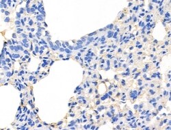 Invitrogen Mammaglobin A Polyclonal Antibody 100 &mu;L; Unconjugated:Antibodies,