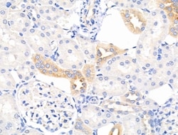 Invitrogen Mammaglobin A Polyclonal Antibody 100 &mu;L; Unconjugated:Antibodies,