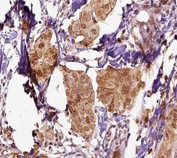 Invitrogen Mammaglobin A Polyclonal Antibody 100 &mu;L; Unconjugated:Antibodies,