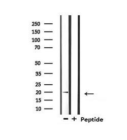 Invitrogen Mammaglobin A Polyclonal Antibody 100 &mu;L; Unconjugated:Antibodies,