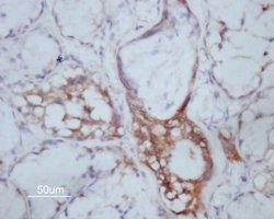 Invitrogen MMP14 Polyclonal Antibody 100 &mu;L; Unconjugated:Antibodies,