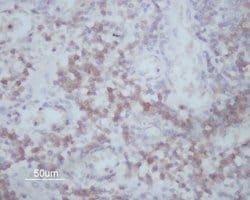 Invitrogen MMP14 Polyclonal Antibody 100 &mu;L; Unconjugated:Antibodies,