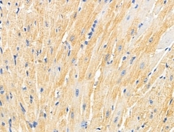 Invitrogen MMP14 Polyclonal Antibody 100 &mu;L; Unconjugated:Antibodies,