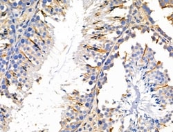 Invitrogen MMP14 Polyclonal Antibody 100 &mu;L; Unconjugated:Antibodies,