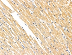 Invitrogen MMP14 Polyclonal Antibody 100 &mu;L; Unconjugated:Antibodies,
