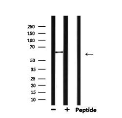Invitrogen MMP14 Polyclonal Antibody 100 &mu;L; Unconjugated:Antibodies,