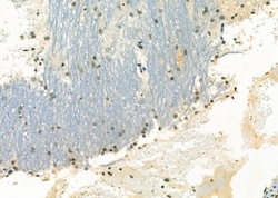 Invitrogen NKX3.1 Polyclonal Antibody 100 &mu;L | Buy Online | Invitrogen&trade; | Fisher Scientific