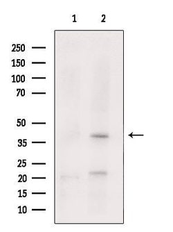 Invitrogen NKX3.1 Polyclonal Antibody 100 &mu;L | Buy Online | Invitrogen&trade; | Fisher Scientific