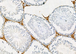 Invitrogen OCT2 Polyclonal Antibody 100 &mu;L; Unconjugated:Antibodies,