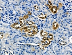 Invitrogen Pan Ras Polyclonal Antibody 100 &mu;L; Unconjugated:Antibodies,
