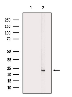 Invitrogen Pan Ras Polyclonal Antibody 100 &mu;L; Unconjugated:Antibodies,