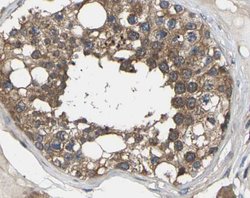 Invitrogen Pan Ras Polyclonal Antibody 100 &mu;L; Unconjugated:Antibodies,