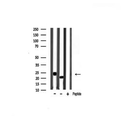 Invitrogen Pan Ras Polyclonal Antibody 100 &mu;L; Unconjugated:Antibodies,