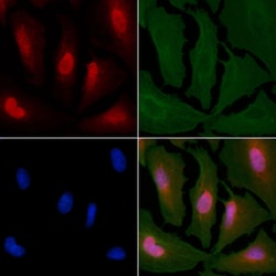 Invitrogen Sodium Channel Pan Polyclonal Antibody 100 &mu;L; Unconjugated:Antibodies,