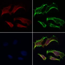 Invitrogen Sodium Channel Pan Polyclonal Antibody 100 &mu;L; Unconjugated:Antibodies,