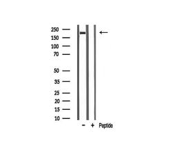 Invitrogen Sodium Channel Pan Polyclonal Antibody 100 &mu;L; Unconjugated:Antibodies,