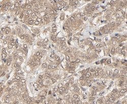 Invitrogen NEDD8 Polyclonal Antibody 100 &mu;L; Unconjugated:Antibodies,
