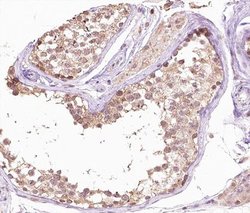 SENP6 Polyclonal Antibody, Invitrogen 100 &mu;L; Unconjugated:Antibodies,