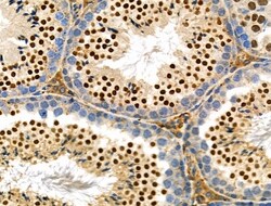 SENP6 Polyclonal Antibody, Invitrogen 100 &mu;L; Unconjugated:Antibodies,