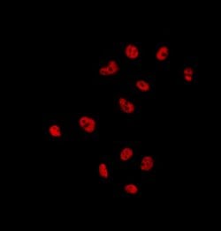 Invitrogen UBA2 Polyclonal Antibody 100 &mu;L; Unconjugated:Antibodies,