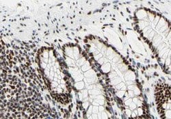 Invitrogen UBA2 Polyclonal Antibody 100 &mu;L; Unconjugated:Antibodies,
